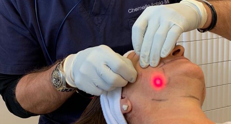 Докладніше про ENDOLIFT® — новинка лазерної естетичної медицини